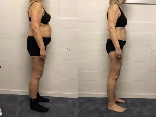 Irene före och efter