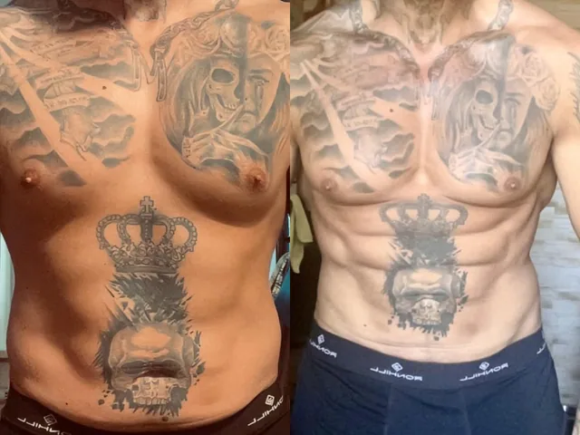 Kim före och efter